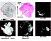 MALDI mass spectrometry imaging of a xenograft tumor grown from a lung cancer cell line