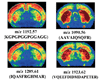 Tryptic peptides generated from the digestion of Neurogranin and PEP-19