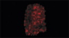 Analyte distribution in tumor