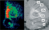 Image of sodiated cerebroside