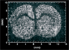 Lipid ion image