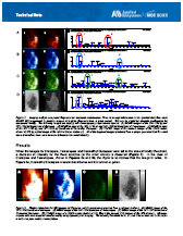 Dynamic Pixel Imaging