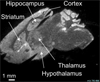 MSI of lipid in mouse brain