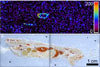 Beta peptide distribution 24 h post dose