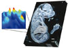 mass spectrometry imaging of glycerophosphatidylcholine