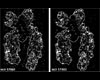 Imaging MS of CypA from normal 3-week CD-1 prostate with 12T-7f prostate tumors.