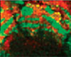 Tryptic-digested protein images of fragments from myelin basic protein (MBP) and histone H2B