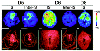 Spatial localization of ubiquitin by imaging MS