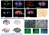 MALDI Imaging analysis of rodent brain slices.