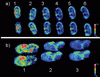 Coronal and parasagittal sections of mouse brain. The plotted mass is 4939 ± 2 Da.