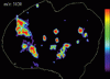 Peptide IMS of the pancreas of ob/ob mouse (m/z 3120)