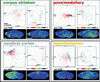 In situ proteomics of the SCR-KO mouse brain using imaging MS and PCA.