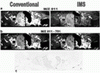 Comparison of (a) m/z 811 and (b) m/z 811-751 images obtained using MALDI-IMS-MS/MS and conventional MALDI-MS/MS