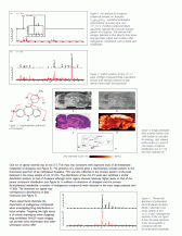 Tissue Imaging MALDI-TOF Mass Spectrometry - Localizing Clozapine in Rat Brain Tissue