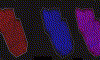 Sagittal section of a rat brain covered with DHB and coated with 2 nm gold afterwards