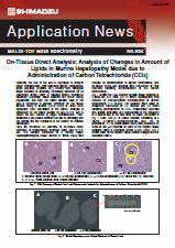 On-Tissue Direct Analysis: Analysis of Changes in Amount of Lipids in Murine Hepatopathy Model due to Administration of Carbon Tetrachloride (CCl4)